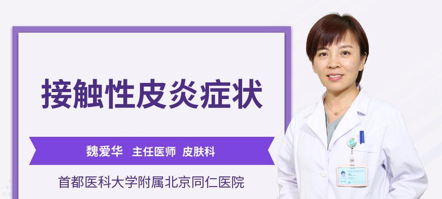 接触性皮炎有哪些症状？医院计划详细症状介绍是什么？